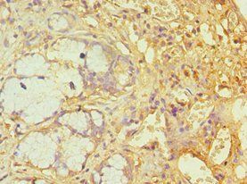 ATXN1 Antibody