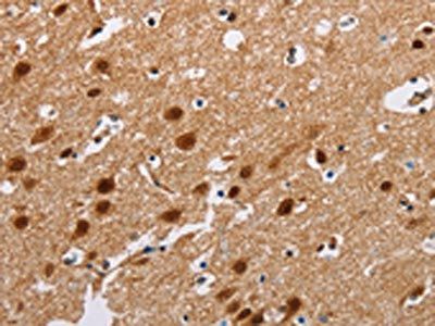 ATXN1 Antibody
