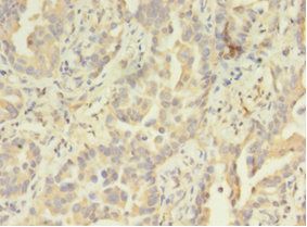 ATXN3 Antibody
