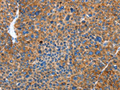 AUP1 Antibody
