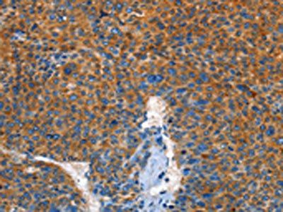 AUP1 Antibody