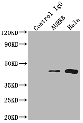 AURKB antibody