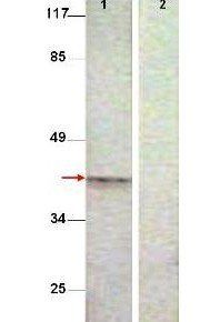 Aurora B (phospho-pT232) antibody