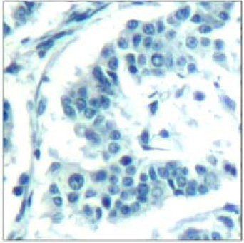 Aurora A (phospho-Thr288) Antibody
