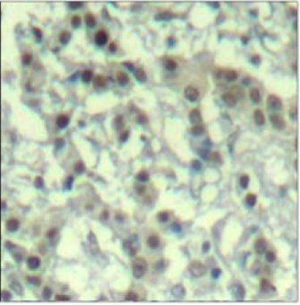 Aurora A (phospho-Thr288) Antibody