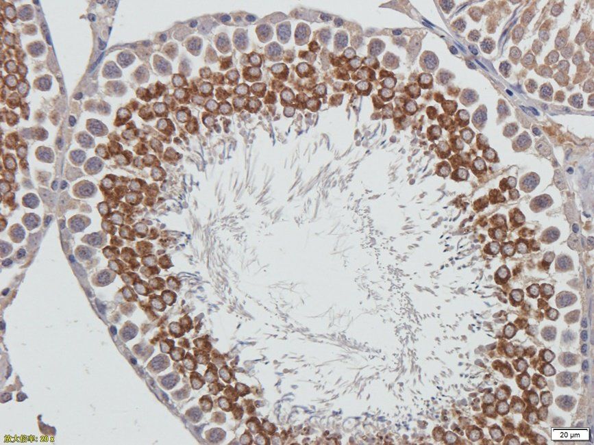 Autotaxin antibody