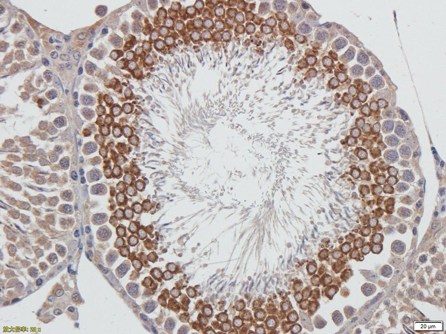 Autotaxin antibody