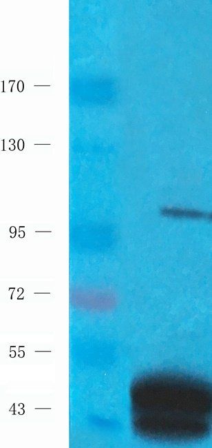 Autotaxin antibody