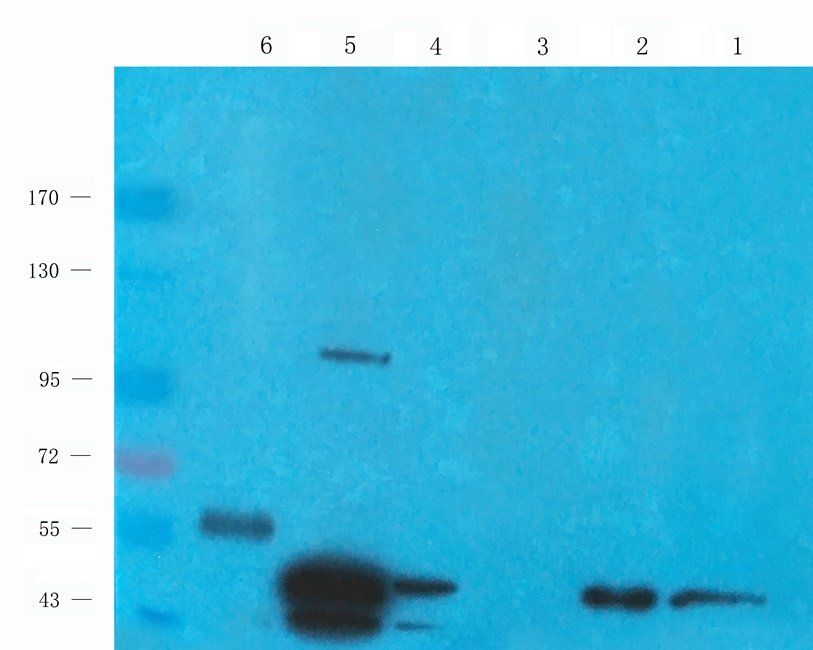 Autotaxin antibody