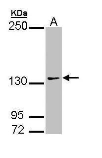 AUTS2 antibody