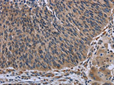 AVEN Antibody