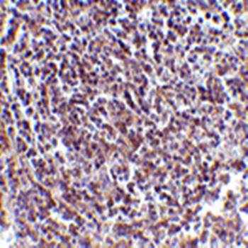 Aven Rabbit Polyclonal Antibody
