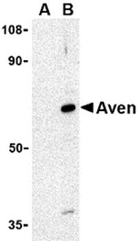 Aven Rabbit Polyclonal Antibody