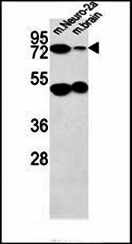 AVL9 antibody