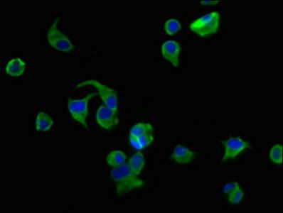 AVPR2 Antibody