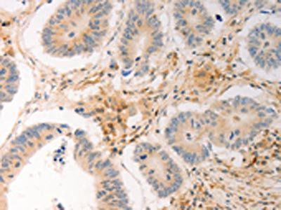 AVPR2 Antibody