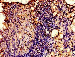 AVPR2 Antibody