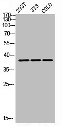 AWAT1 antibody