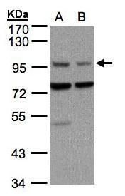 ATP5G1 antibody