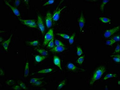 AXL antibody