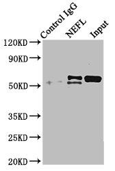 AZGP1 antibody