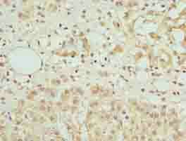 AZIN1 Antibody