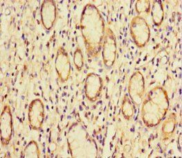 B-cell lymphoma/leukemia 10 antibody