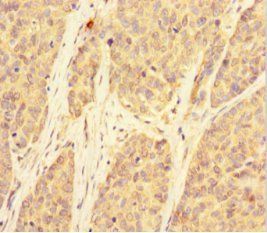 B-cell lymphoma/leukemia 10 antibody