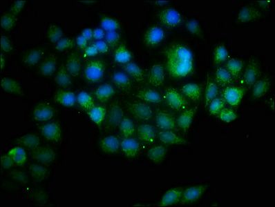 B-cell lymphoma/leukemia 10 antibody