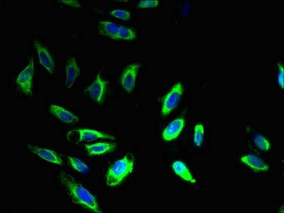 B-cell R-associated protein 31 antibody