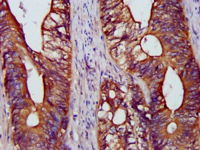 B-cell R-associated protein 31 antibody