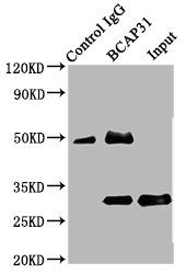 B-cell R-associated protein 31 antibody