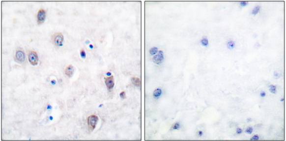 Amyloid β A4 (Ab-743/668) Antibody