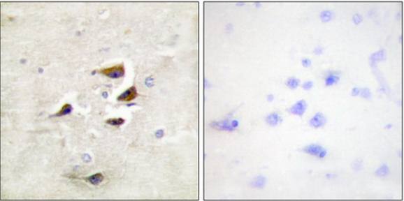 CaMK2α/β/δ (Ab-305) Antibody