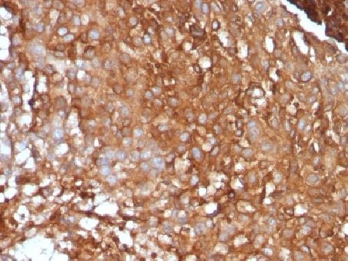 Beta-2 Microglobulin (Renal Failure & Tumor Marker) Antibody