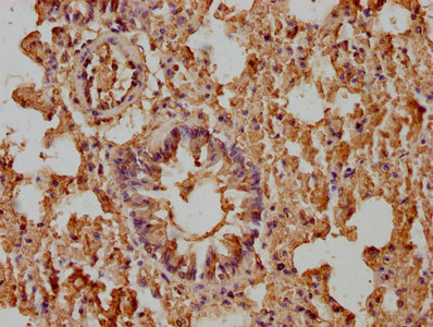 B2m Antibody