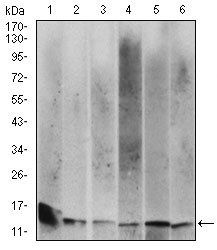 B2M Antibody