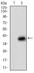 B2M Antibody