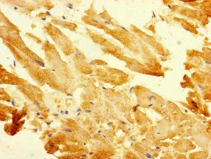 B3GALT2 Antibody