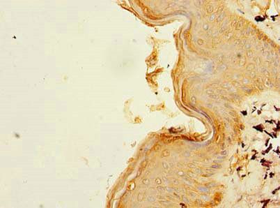 B3GNT2 Antibody