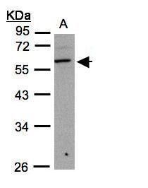 B3GNT3 antibody