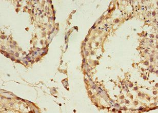 B3GNT5 Antibody