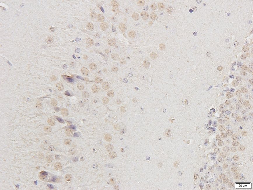 B4GALNT4 antibody