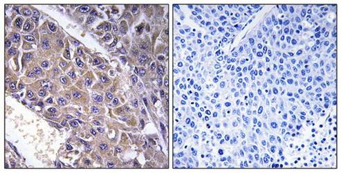 B4GALT3 Antibody