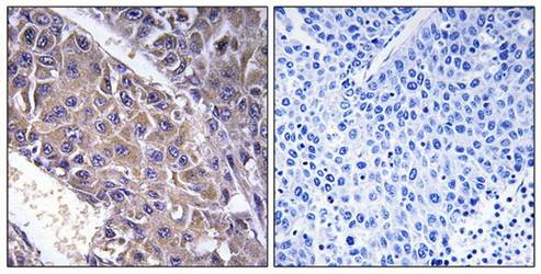 B4GALT3 antibody