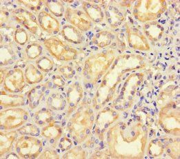 B4GALT5 Antibody
