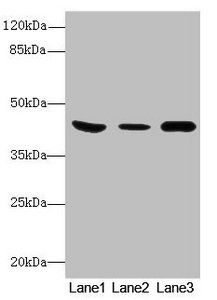 B4GALT5 antibody