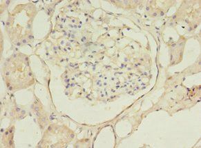 B4GAT1 Antibody