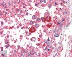 Goat anti-B5 Receptor / PCID1 / EIF3M Antibody