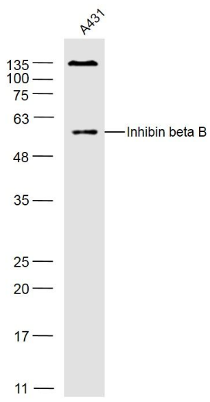 Inhibin beta B antibody
